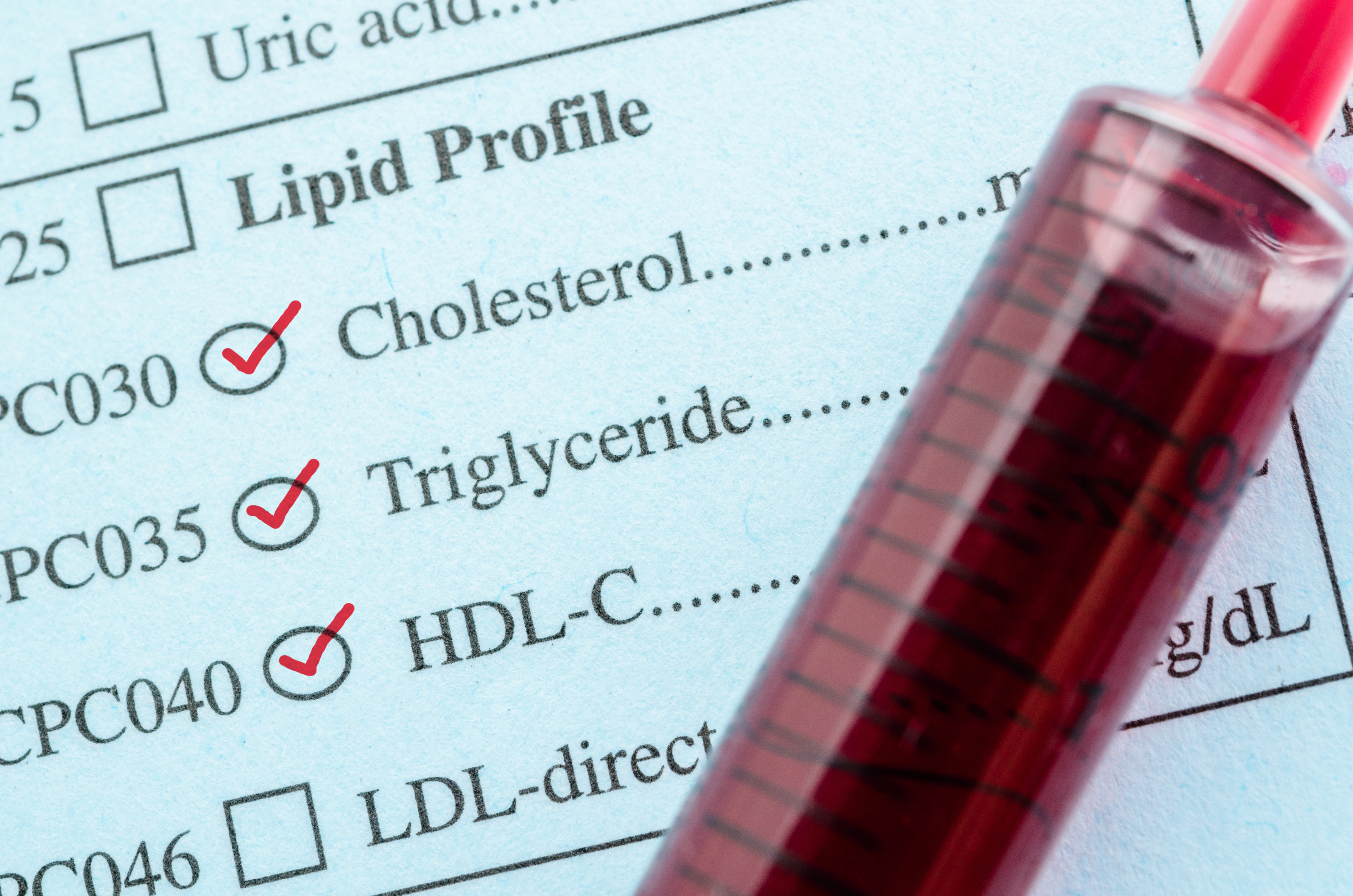 Des taux de cholestérol fluctuent considérablement d'une année à l'autre sans changement de médicament se révèlent ainsi prédictifs d’un risque plus élevé de démence, un peu plus tard dans la vie (Visuel Adobe Stock 111046439)