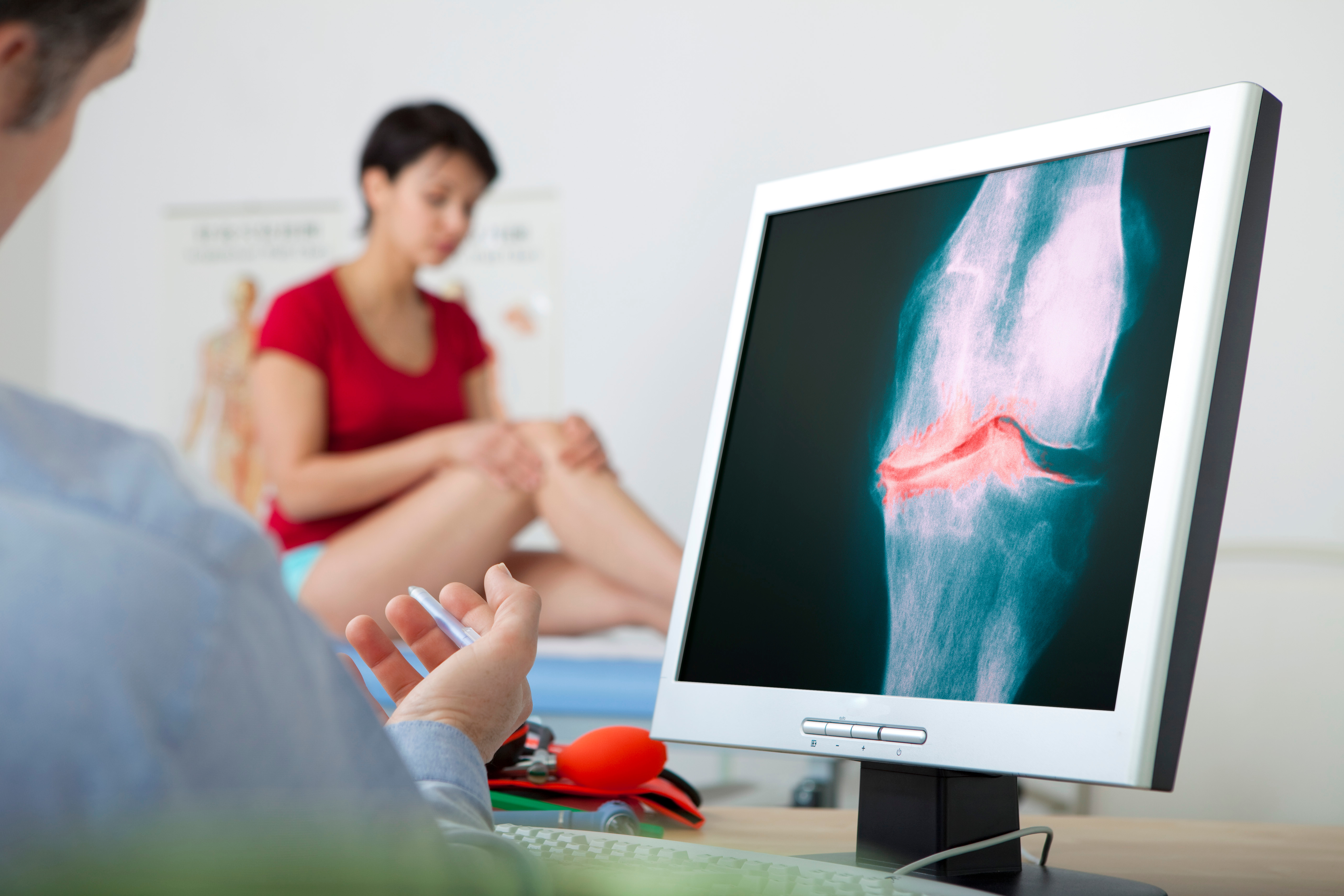 L'espoir d'un nouveau traitement pour l'arthrose du genou