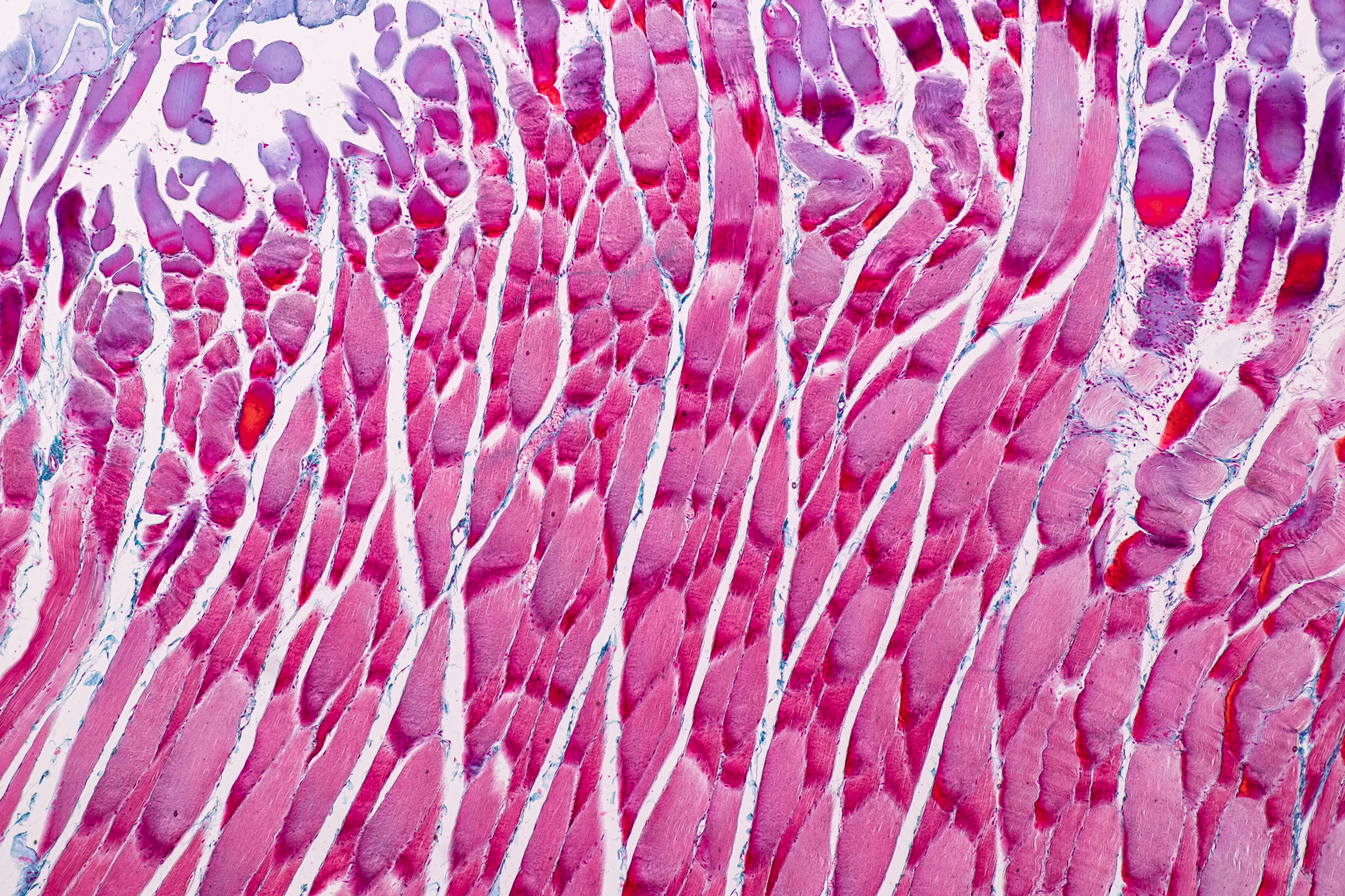 L'étude met en évidence une nouvelle interaction entre un type de cellules immunitaires et un type de cellules souches, une interaction qui stimule la fibrose caractéristique de la dystrophie musculaire (Visuel Adobe Stock 255956721)