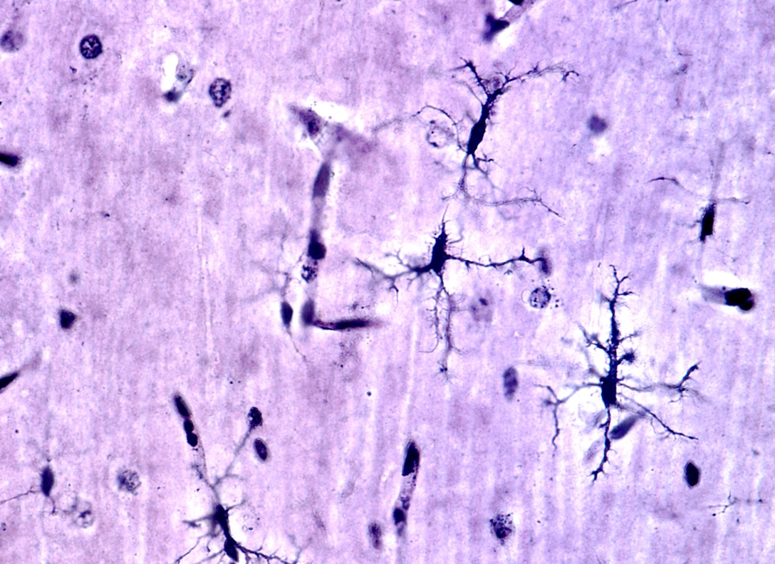 La gyrification cérébrale a déjà été associée à différents troubles neurologiques (Visuel Adobe stock 398867897)