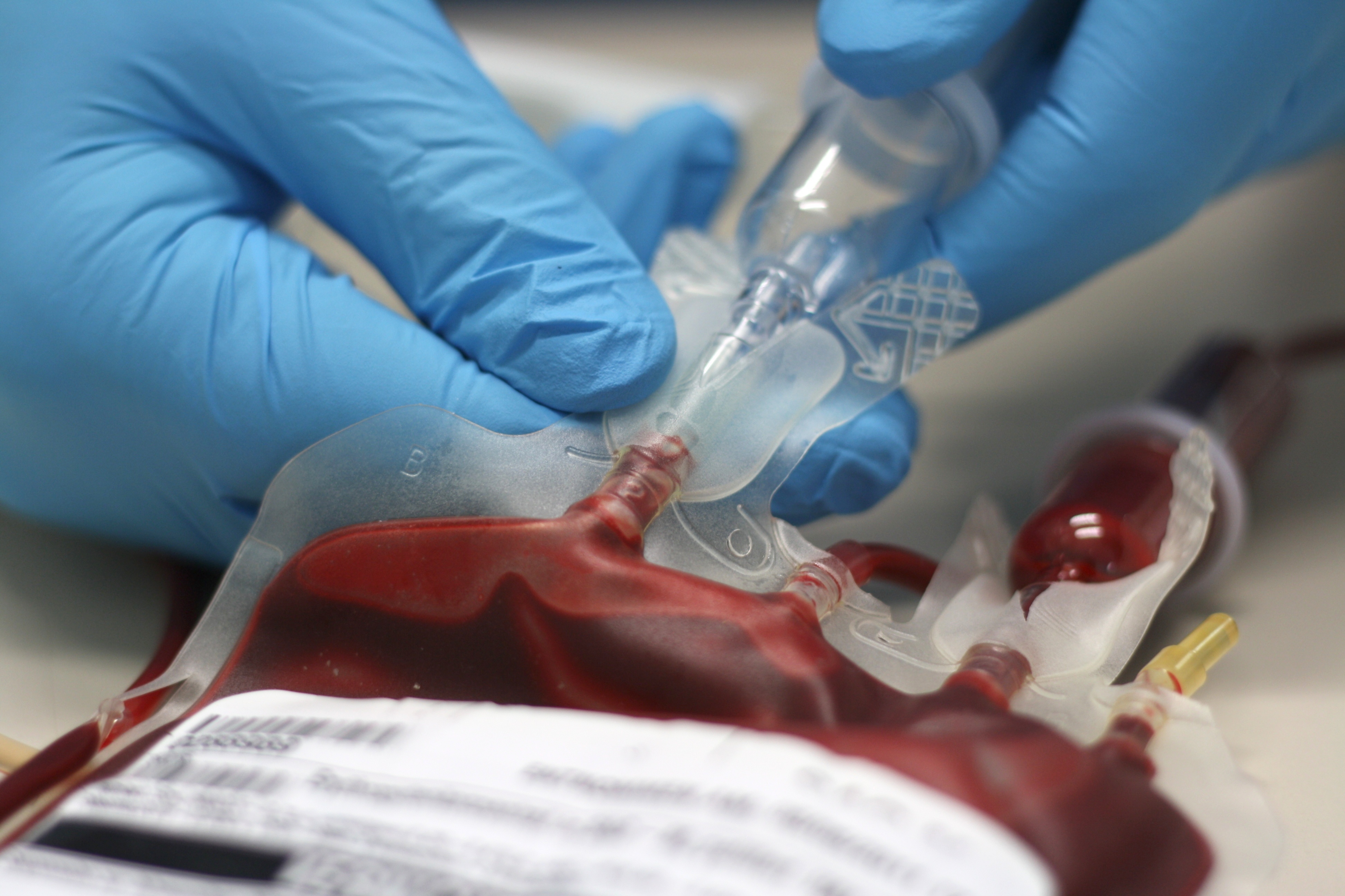 What Is Whole Blood Transfusion