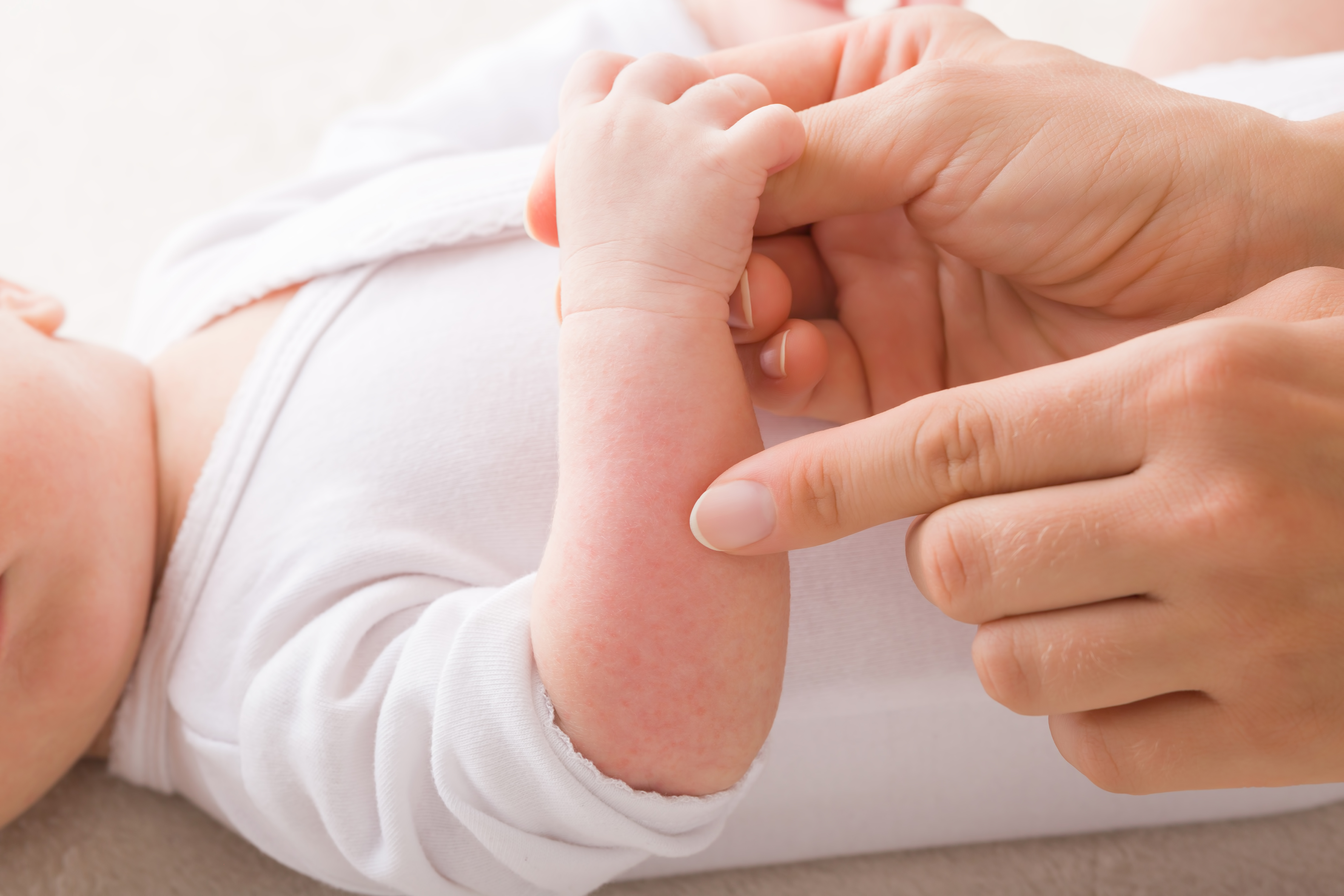 Cette recherche a permis  de découvrir des biomarqueurs cutanés chez les nourrissons, prédictifs du développement précoce d'allergies alimentaires (Visuel Adobe Stock 552271852)