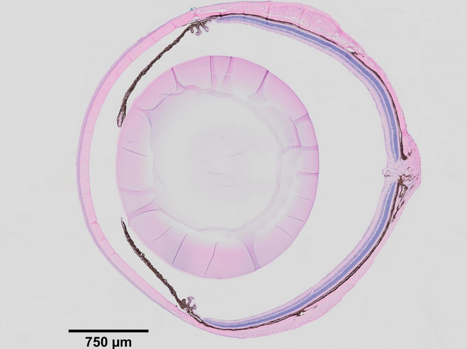 Et si les affections oculaires dégénératives qui conduisent au glaucome, à la dystrophie cornéenne et à la cataracte pouvaient être détectées et traitées avant que la vision ne soit altérée ? (Visuel Corps ciliaire- Ting Xie Lab) 