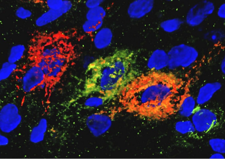 Ces neurones glucorégulateurs, présents dans l'éminence médiane du noyau arqué hypothalamique du cerveau, enchevêtrés dans des matrices extracellulaires appelées réseaux périneuronaux peuvent avoir un effet de régulation de la glycémie (Visuel Courtesy of KImberly Alonge/Schwartz Lab/UW Medicine Diabetes Research Institute)