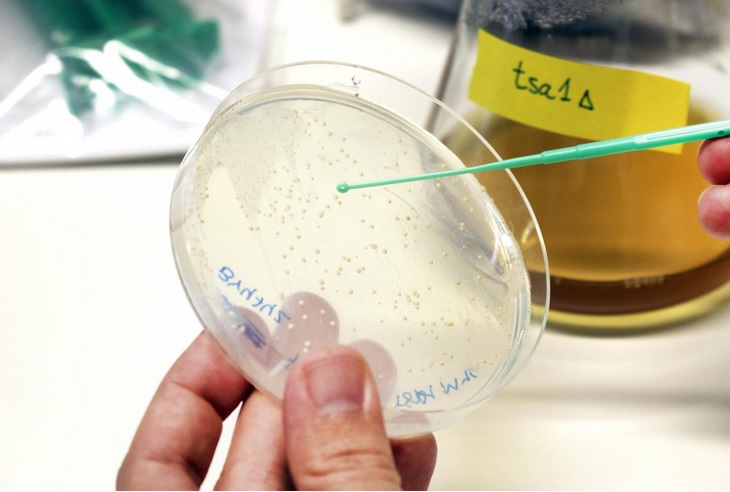 La levure constitue un bon système modèle pour étudier le vieillissement cellulaire (Visuel Martina Butorac/Chalmers University of Technology)