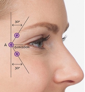 Rajeunissement Du Visage Toxine Botulique Tout Est Dans La Technique Sante Log