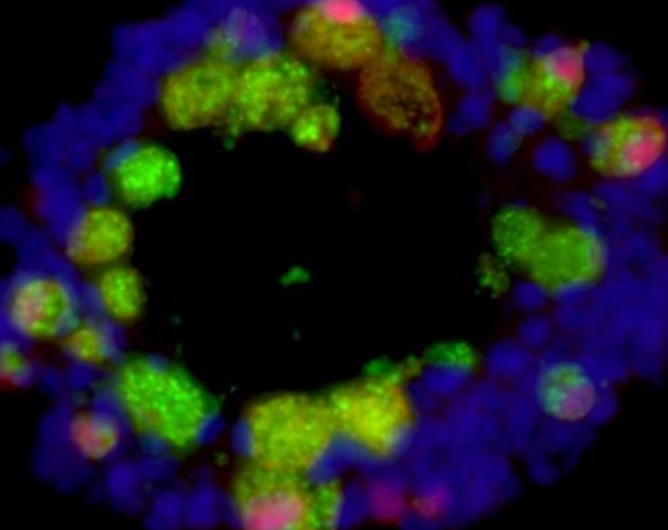 Au centre de ces effets progressifs et délétères, les cellules de Paneth (vertes et rouges sur visuel ci-dessous) qui participent au contrôle de l'inflammation dans l’intestin (Visuel Ta-Chiang Liu)