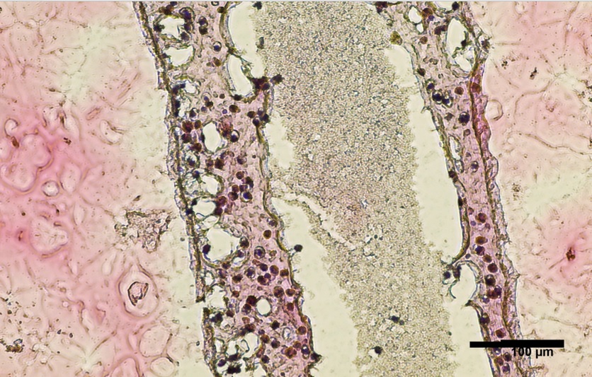 Les cellules ont été cultivées et imprimées en 3D dans ne boîte de Pétri dans une structure tubulaire creuse qui ressemble aux tubes séminifères humains producteurs de sperme (Visuel Courtesy of Dr. Ryan Flannigan)