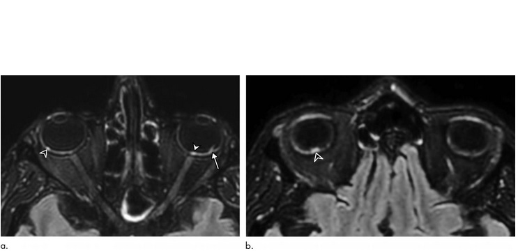 Visuel Radiological Society of North America