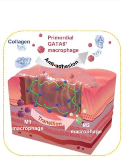 HAD semble adapté à une administration post-laparotomie pour former une barrière anti-adhérence instantanée in situ avec de bons effets cicatrisants (Visuel Yaobin Wu, Guangdong Engineering Research Center for Translation of Medical 3D Printing Application).