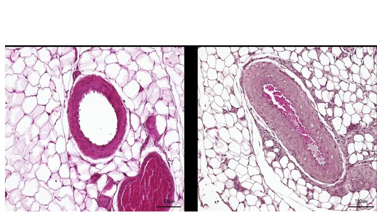 Dr. Q. Fatimunnisa, Bader Lab, MDC