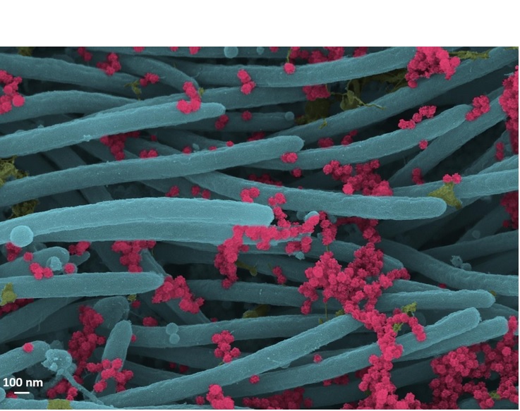 Un nombre incroyablement élevé de virions produits et libérés par chaque cellule du système respiratoire humain (Visuel Ehre Lab, UNC School of Medicine)