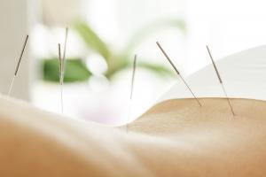 L'acupuncture peut-elle contribuer à réduire les bouffées de chaleur et autres effets secondaires du traitement antihormonal du cancer du sein ? (Visuel Adobe Stock 166030227)