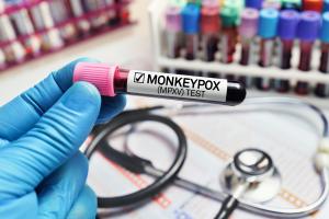Bien que les cas de mPox aient fortement diminué depuis l'épidémie mondiale de 2022, la variole du singe continue de circuler à bas bruit chez les hommes ayant des rapports sexuels avec des hommes HSH) (Visuel Adobe Stock 506616350)
