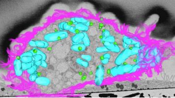 Les graisses ne servent pas seulement à stocker de l’énergie mais elles permettent aussi à nos cellules de combattre les bactéries (Visuel Institute for Molecular Bioscience, University of Queensland)