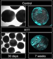 Le syndrome de Rett est une maladie génétique définie par une anomalie sévère du développement du système nerveux central, il survient uniquement chez les filles (visuel Kyushu University/Nakashima Lab)