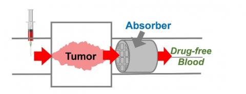 Cette éponge médicamenteuse pourrait minimiser les effets secondaires des chimiothérapies