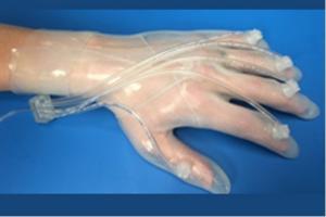 Ce gant cicatrisant répond en effet à un véritable besoin, à la fois sur les zones de combat mais aussi en santé communautaire : il permet d’accélérer la cicatrisation des plaies complexes de la main.