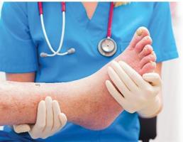 La « maladie du pied diabétique » est l’une des principales causes d’invalidité dans le monde, avec un taux de mortalité supérieur à celui de nombreux cancers. 
